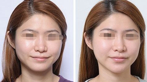 2024成都璞齡醫(yī)療美容價(jià)格與專家門診服務(wù)一覽