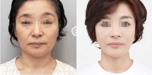 煙臺磨骨手術(shù)最適合的醫(yī)院在哪里尋找？