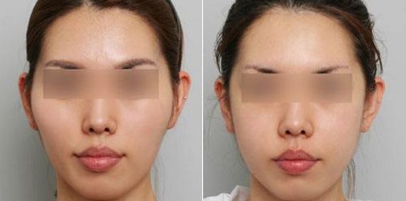 【日照】專業(yè)激光去斑醫(yī)院推薦！一站式解決肌膚斑點困擾