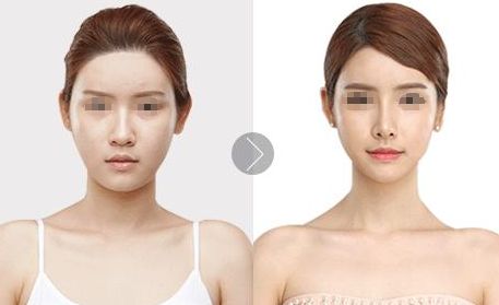 北京植發(fā)醫(yī)院推薦，哪家效果好？