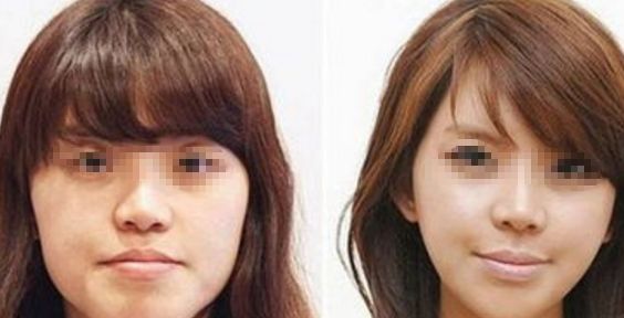 北醫(yī)三院植發(fā)科室介紹與謝祥醫(yī)生評(píng)價(jià)