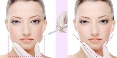 2024年成都哪家正畸醫(yī)院口碑好？價格查詢澤西醫(yī)生正畸美團(tuán)優(yōu)惠