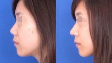 中山地區(qū)五家受網(wǎng)友認(rèn)可的專業(yè)整形醫(yī)院