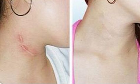 中國(guó)權(quán)威的豐胸醫(yī)院排行榜出爐，哪家效果最佳？