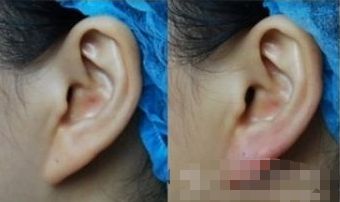 湖州哪家醫(yī)院能有效提升面部外觀？