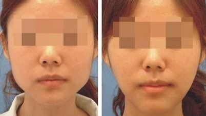 廣州中家醫(yī)家庭醫(yī)生整形美容醫(yī)院價目表及專家推薦