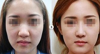 集安知名整形診所徐秀云外科口碑如何？收費標準和服務(wù)詳情揭秘