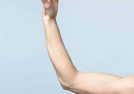 連云港眼袋術(shù)后瞼外翻修復(fù)醫(yī)生