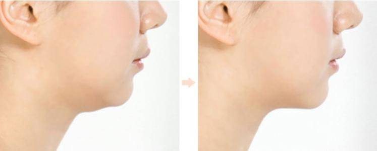 天津斑道夫激光祛斑醫(yī)生