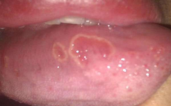 上海乳頭溝修復醫(yī)生