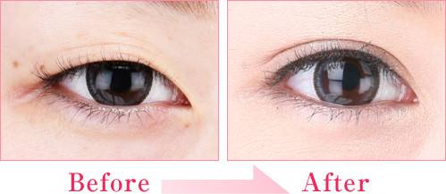 重慶鼻尖抬高醫(yī)生