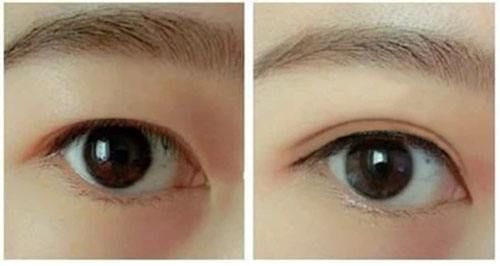 秦皇島深藍(lán)射頻面部醫(yī)生