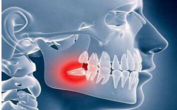 珠海玻尿酸祛雀斑醫(yī)生