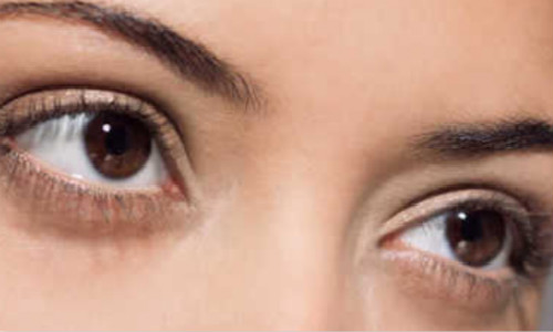 寧波點(diǎn)陣祛動(dòng)態(tài)細(xì)紋醫(yī)生