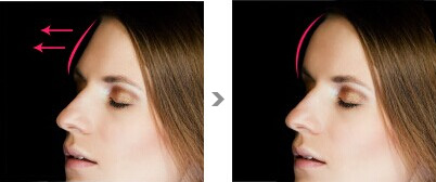 天津去眼部皺紋醫(yī)生