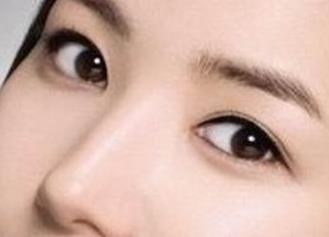 廣州無(wú)針去除口周紋醫(yī)生