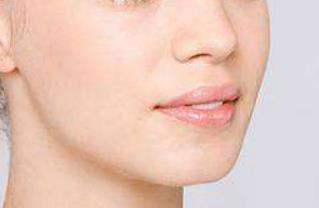 南寧膨體豐額頭醫(yī)生