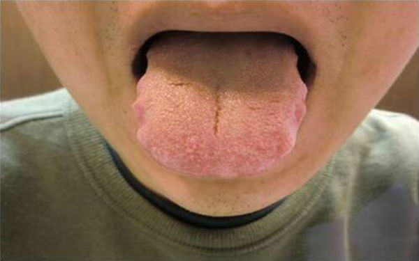 西寧下頜角修復醫(yī)生