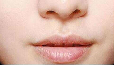 南通頸部皺紋醫(yī)生