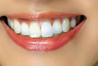 威海玻尿酸打眉骨醫(yī)生