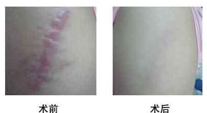 西安注射玻尿酸填充顳部醫(yī)生