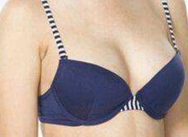 長(zhǎng)沙手術(shù)祛除眉間紋醫(yī)生