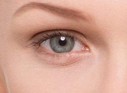 臨沂自體真皮填充淚溝醫(yī)生