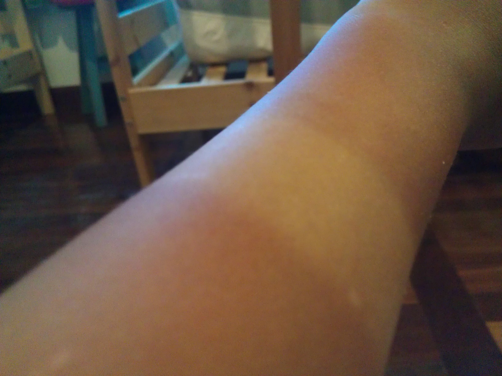 六盤頸部皺紋激光祛除醫(yī)生