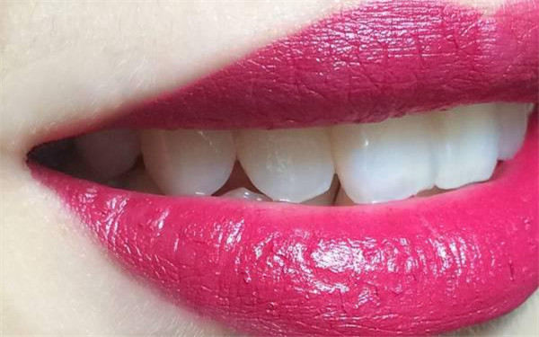 銀川治療痘印醫(yī)生