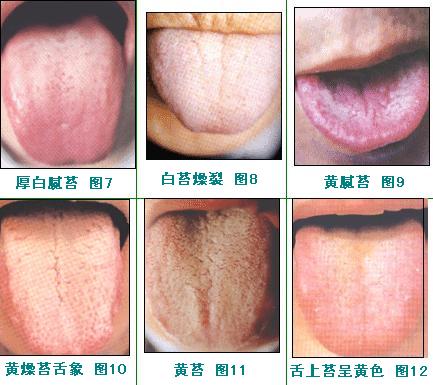 株洲眼紋微創(chuàng)提升醫(yī)生