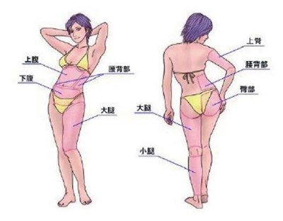 武漢光纖溶脂祛動態(tài)細(xì)紋醫(yī)生