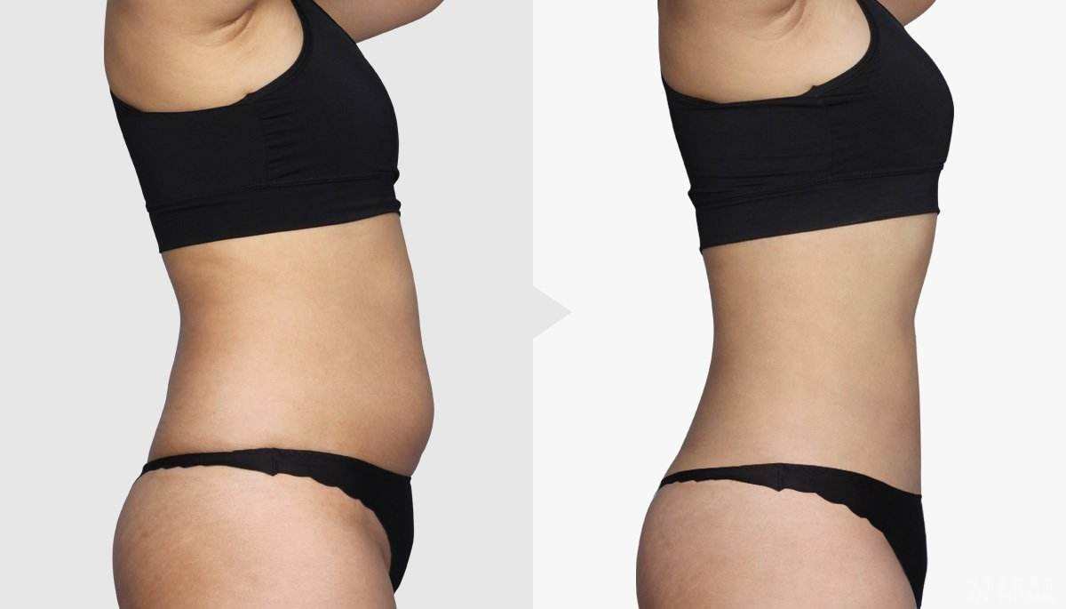 杭州手術(shù)除黑痣醫(yī)生