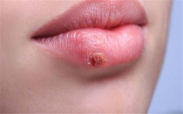 天津乳頭射頻懸吊醫(yī)生