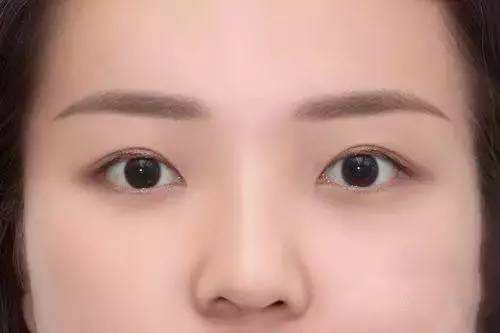 長(zhǎng)治熱瑪吉祛疤醫(yī)生