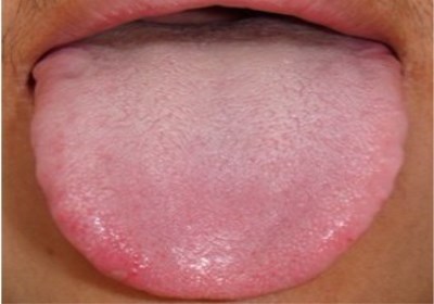 淮安鼻子綜合整形醫(yī)生