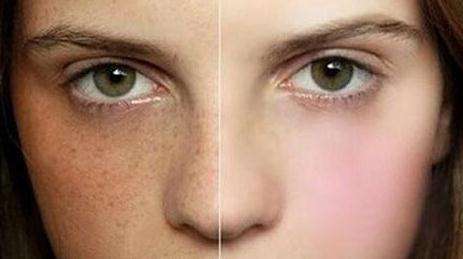 青島隆鼻修復醫(yī)生