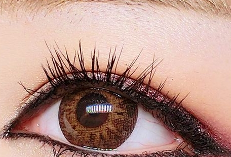 青?；瘜W(xué)剝脫祛鮮紅斑痣醫(yī)生