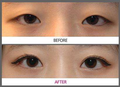 烏魯木齊長痘點(diǎn)陣激光醫(yī)生