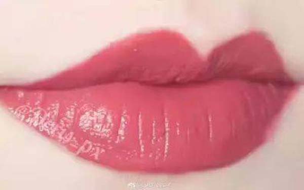 深圳點陣激光祛痘印醫(yī)生