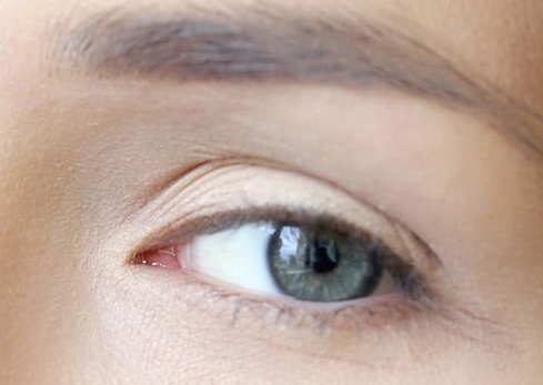 商丘消除眼角紋術醫(yī)生