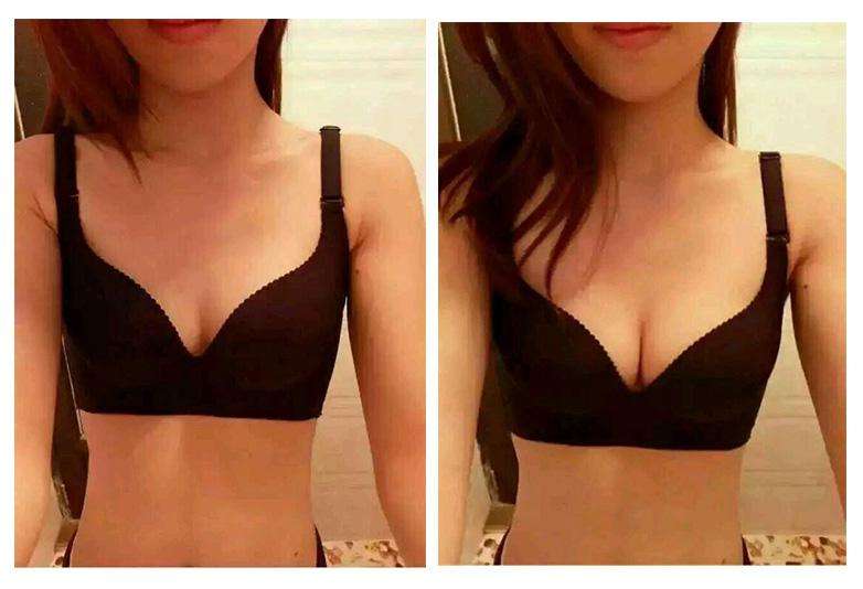 廣州熱瑪吉去頸部皺紋醫(yī)生