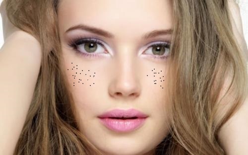 洛陽瘦臉針進口品牌醫(yī)生