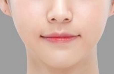 周口點(diǎn)陣激光去黑色素醫(yī)生