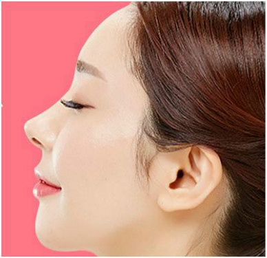 江西干細(xì)胞去木偶紋醫(yī)生