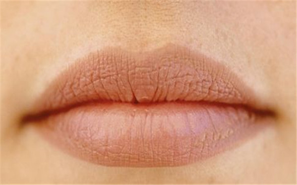 南通面部硅膠填充醫(yī)生