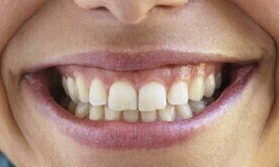 鄭州潤白顏玻尿酸醫(yī)生