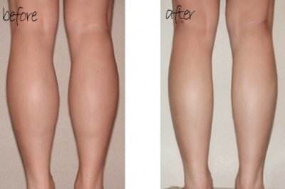 寧波筋膜懸吊去眼袋醫(yī)生