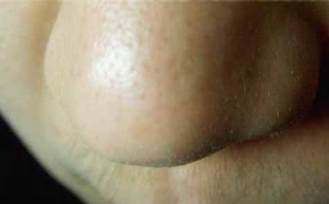 長(zhǎng)春假體墊鼻基醫(yī)生