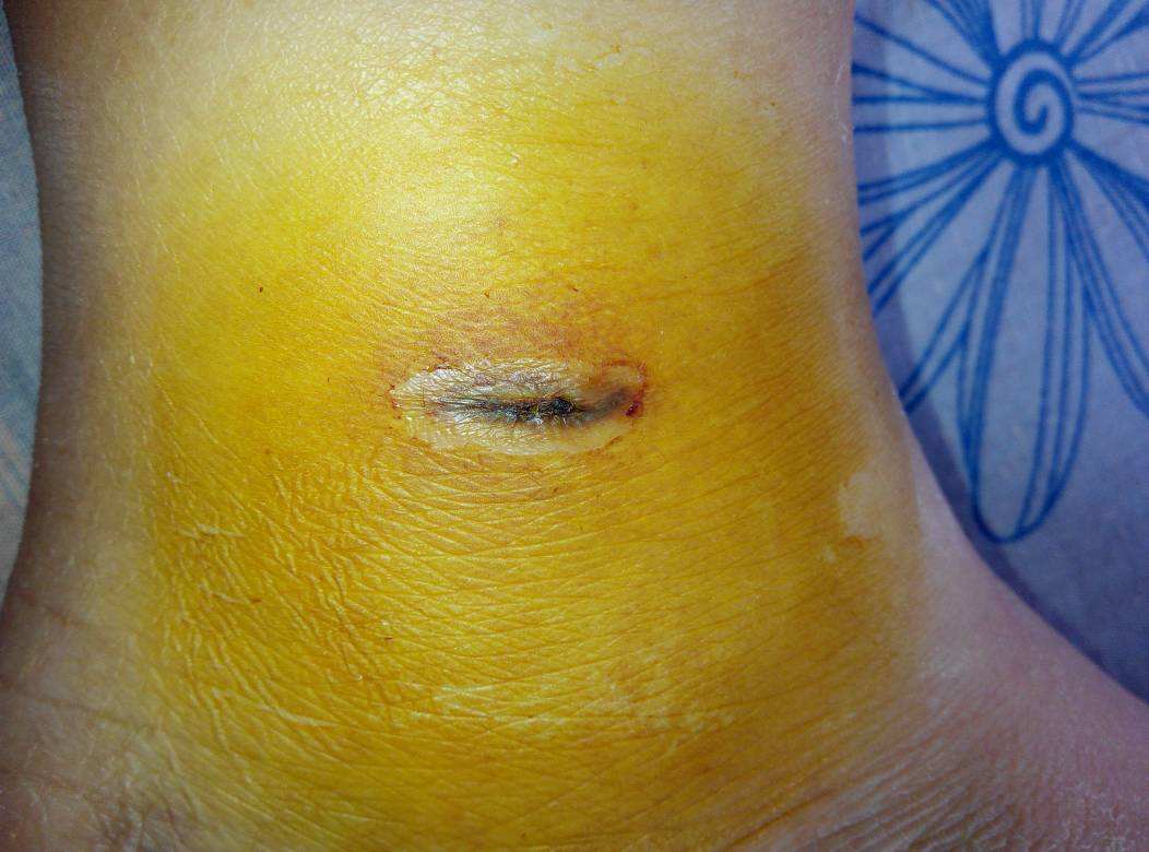 南京肋骨鼻基底填充醫(yī)生