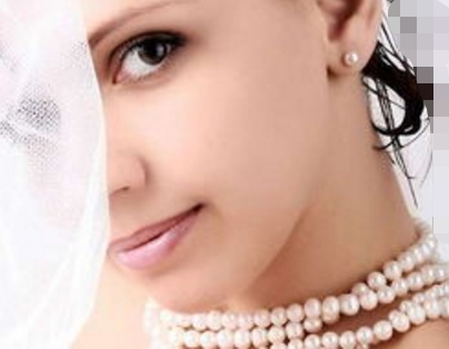 東陽(yáng)日式無(wú)痕水波拉皮醫(yī)生